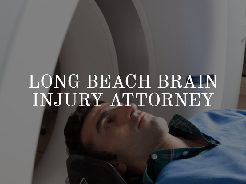 Long Beach Brain Injury Attorney